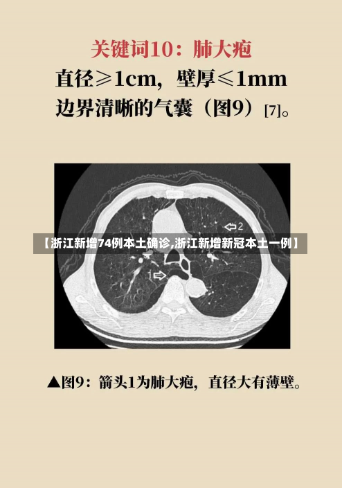 【浙江新增74例本土确诊,浙江新增新冠本土一例】