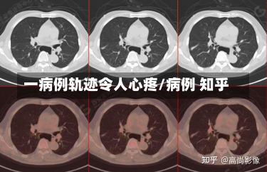 一病例轨迹令人心疼/病例 知乎