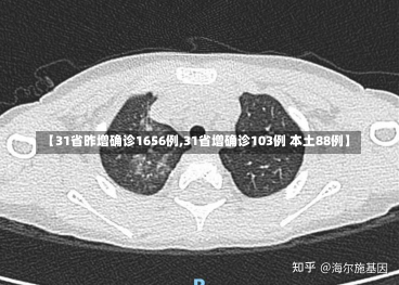 【31省昨增确诊1656例,31省增确诊103例 本土88例】