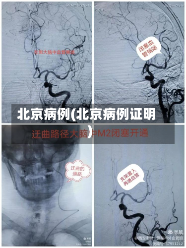 北京病例(北京病例证明)