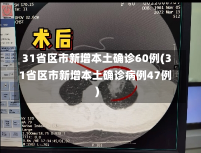 31省区市新增本土确诊60例(31省区市新增本土确诊病例47例)