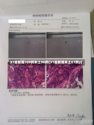 31省新增109例本土96例(31省新增本土61例p)